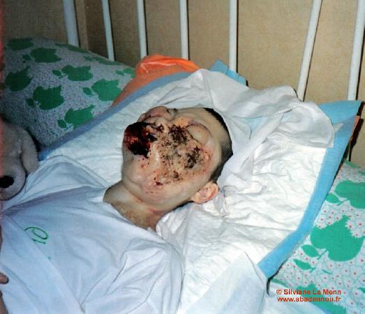 Coralie sur son lit de mort après l\'euthanasie clandestine et ratée ! Souffrances inutiles et supplémentaires !